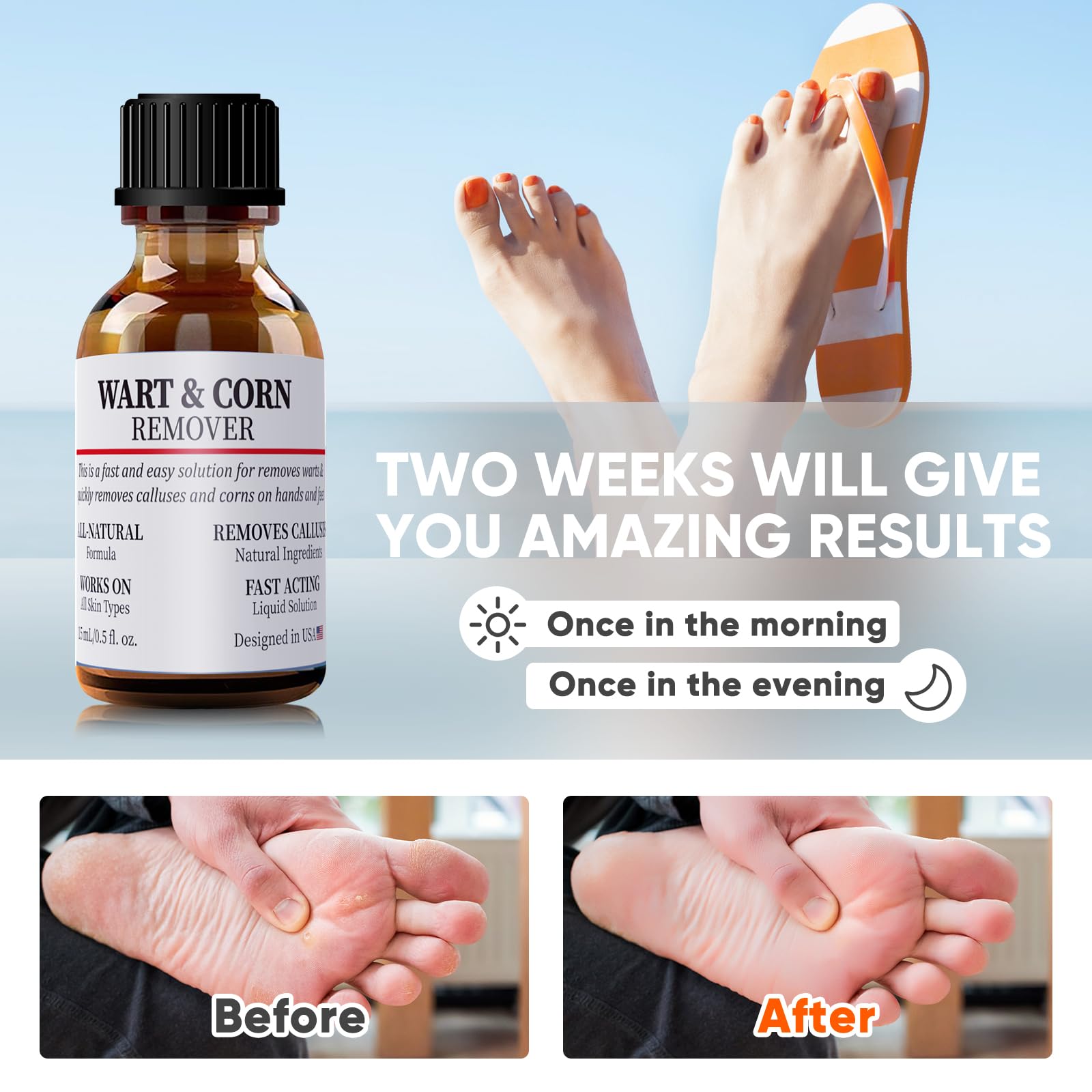 WABRINY Wart & Corn Remover Liquid, Smoothes Skin Gentle Fast Acting Gel Wart Removal for Plantar Wart Flat Warts and Corns-G3