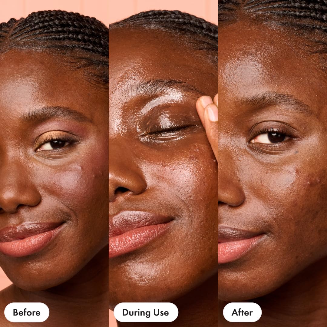 HERO COSMETICS Dissolve Away Daily Cleansing Balm - Helps Remove Makeup and Grime - Wonât Clog Pores - Suitable for Sensitive and Acne-Prone Skin (2.2 fl oz)