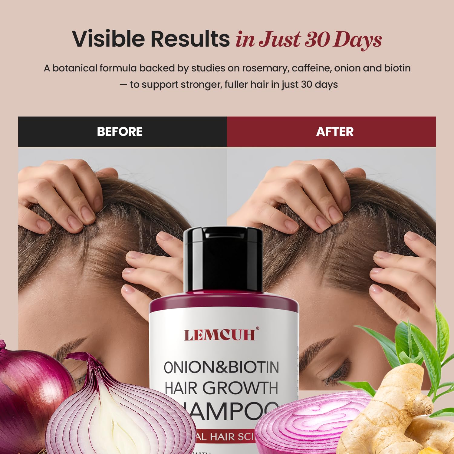 Onion Shampoo for Hair Growth: Onion Hydrosol Shampoo for Thicker-Looking Hair - Smooths Scalp With Tea Tree & Ginger - Thickening Formula Support Hair Regrowth For Women Men 12.5Fl Oz