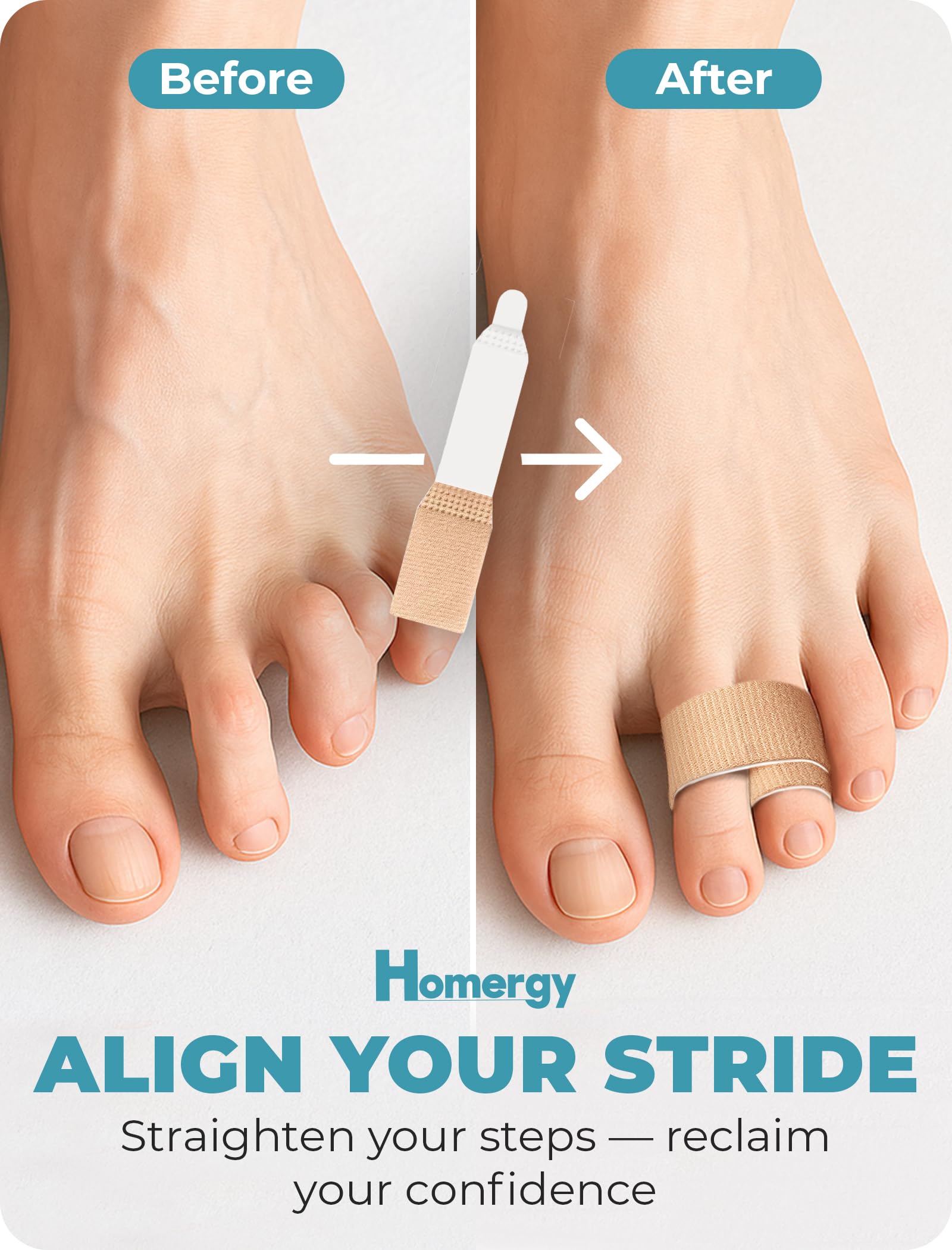 Homergy Hammer Toe corrector for Women and Men, 4 Pack, (Next Generation), Reusable Fabric Buddy Wraps for Broken Toes, Hammertoe Corrector