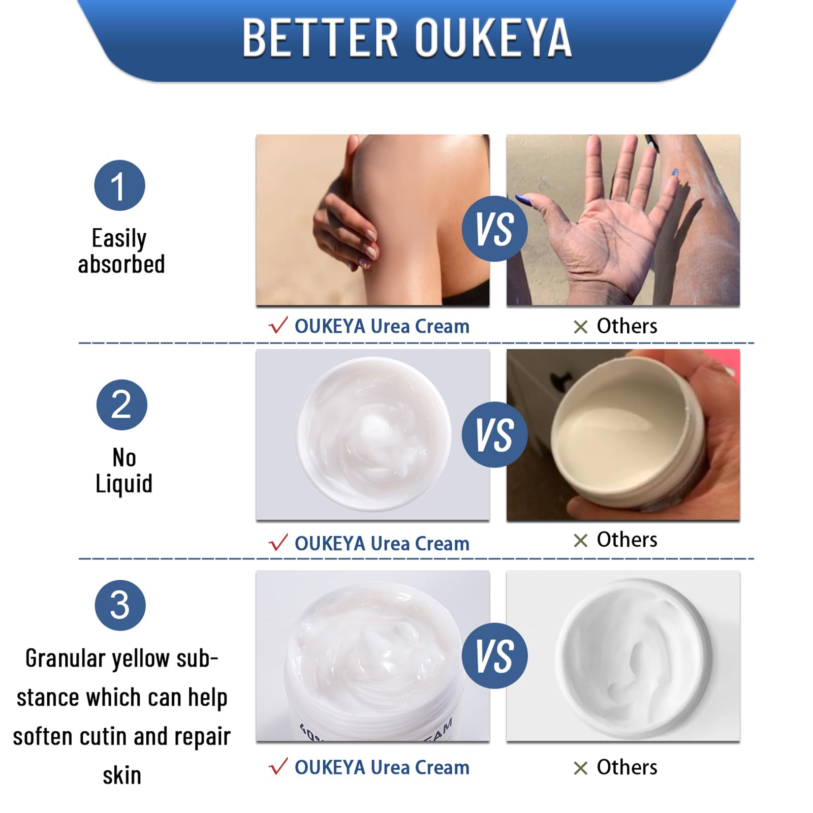 OUKEYA Urea Cream 40 Percent, Urea Foot & Hand Cream for Dry Cracked, 40 per Urea Lotion for Feet Maximum Strength