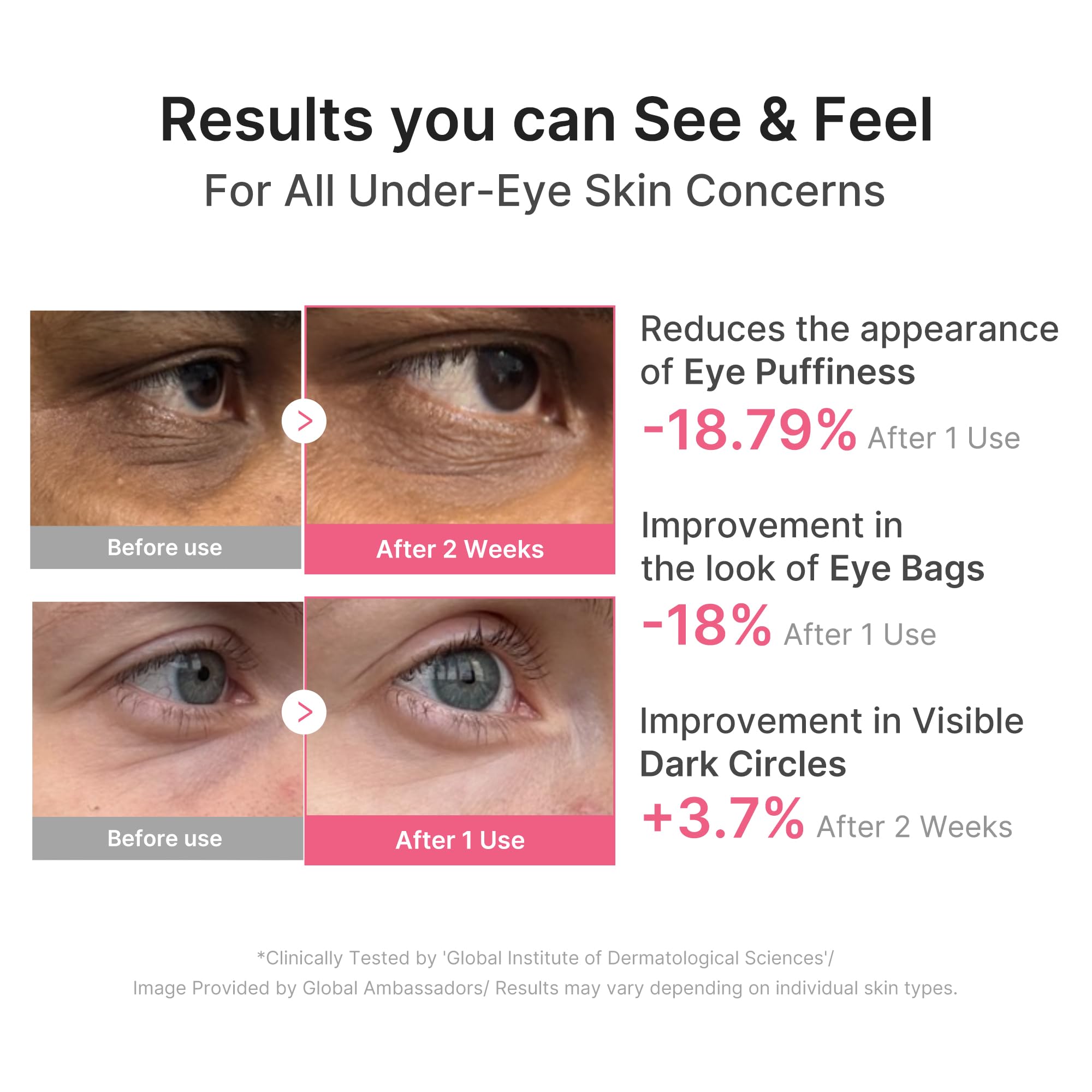medicube PDRN Caffeine Collagen Eye Patch | Gel Eye Patches for the appearance of Dark Circles, Undereye Bags | Firming, Age-Defying Care with Retinol, Collagen | Korean Skincare | 30 Pairs