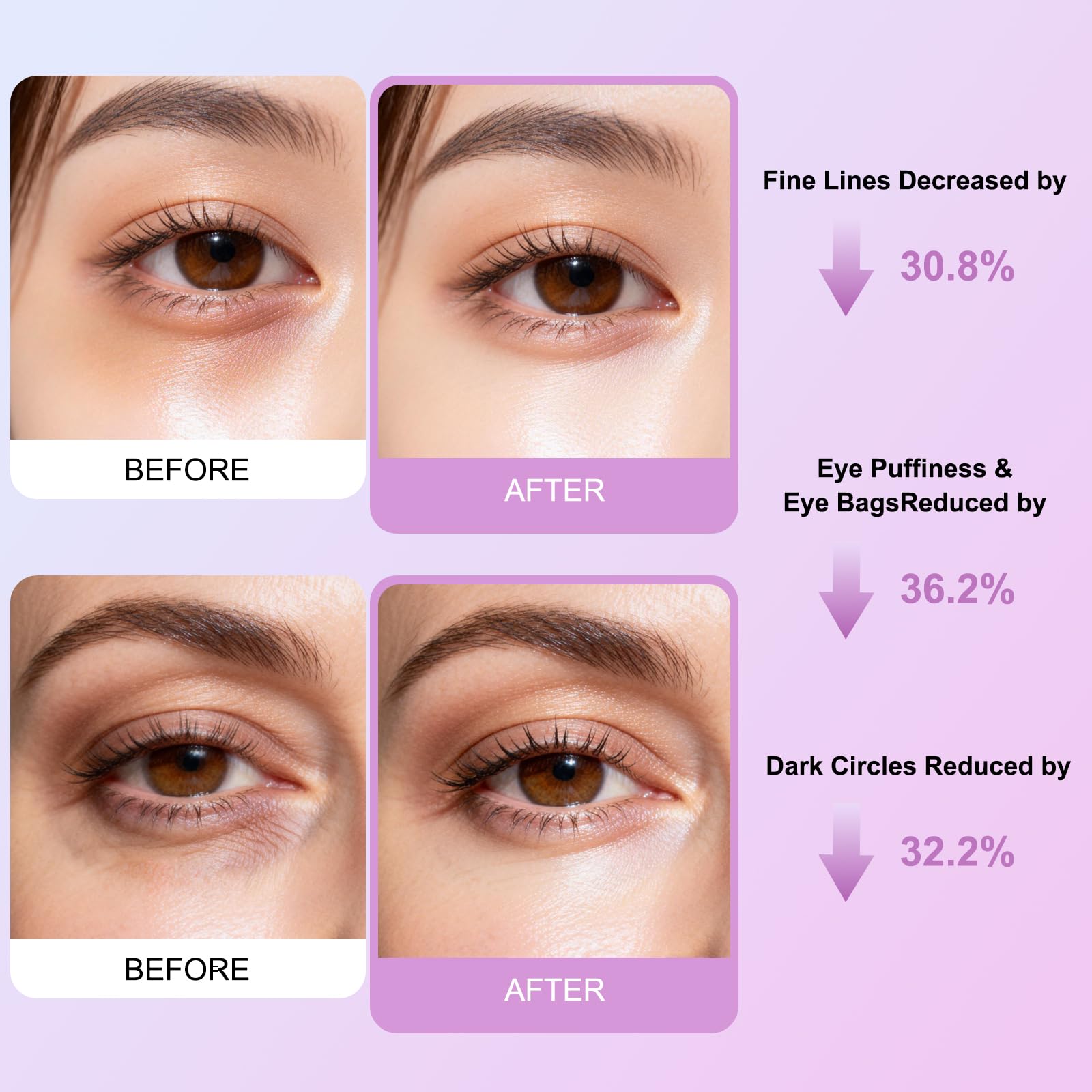 SBONFE Instant Firm Under Eye Patches - Collagen Firming & Lifting Eye Masks | Reduce Puffiness, Dark Circles, Fine Lines & Wrinkles | with Hyaluronic Acid for Hydration & Firming, 8 Pair Pack