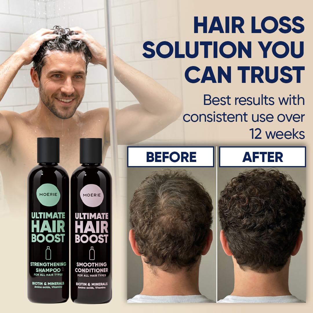 Moerie Hair Growth Shampoo and Conditioner for Women and Men, Hair Loss Solution with Biotin and Rosemary, Thickening Shampoo and Conditioner for Thinning Hair – Promotes Regrowth