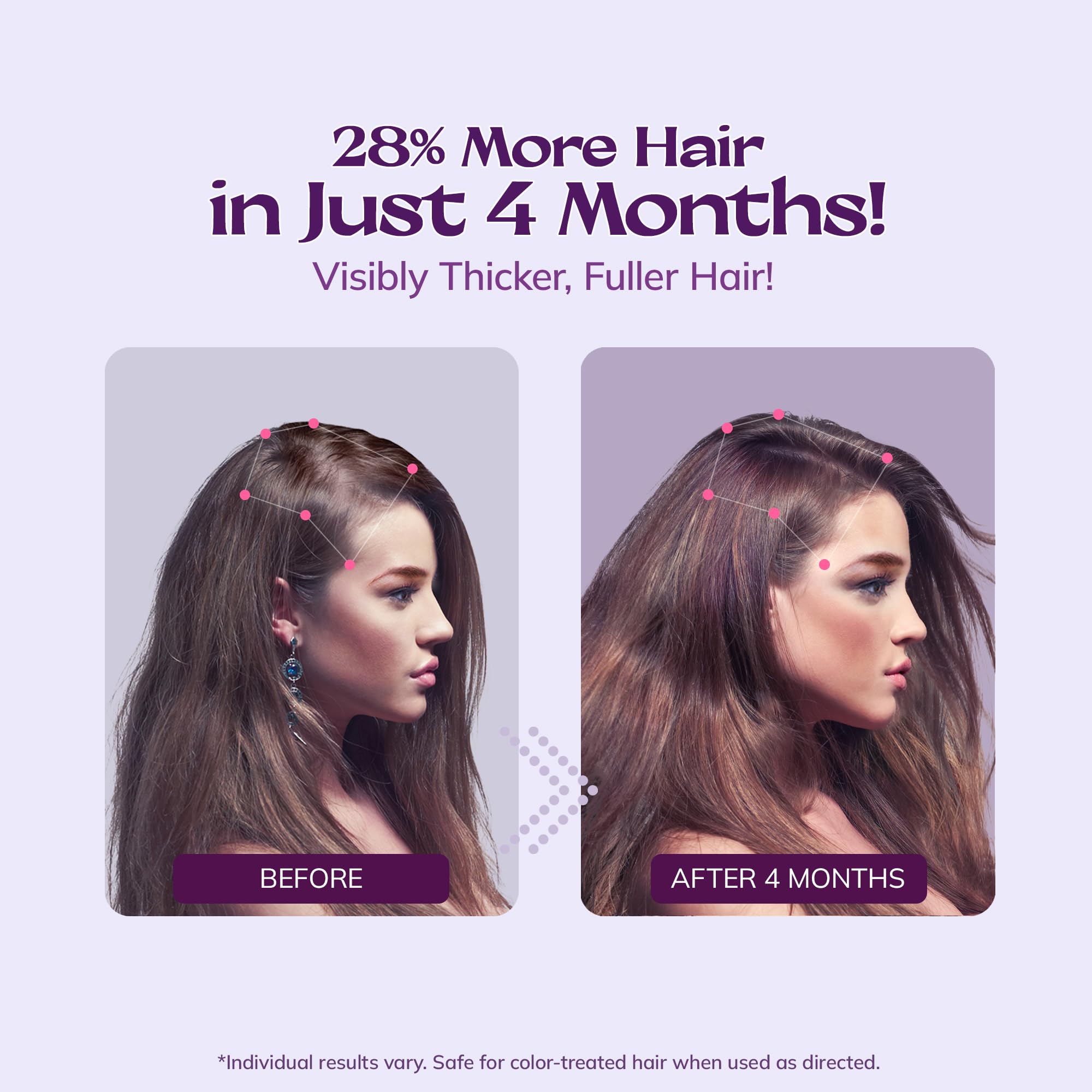 Women's 5% Minoxidil Spray for Hair Growth: 2-Pack RootStim Extra Strength Minoxidil with Rosemary & Biotin for Thinning Hair Regrowth and Fuller Hair - 60ML Each