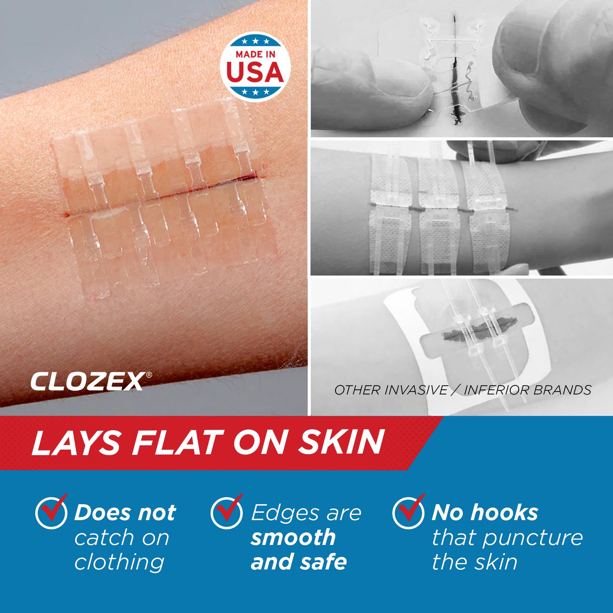 Clozex Wound Closure Device - Repair 3 Individual 3 3/8" Lacerations Without Stitches, FDA Cleared