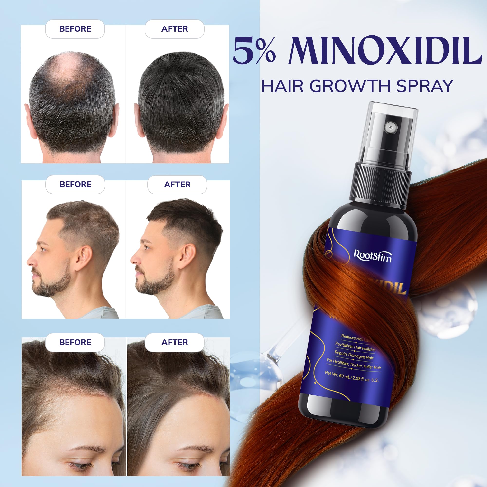 Hair Growth Serum (60ml) + Hair Growth Foam (6 fl.oz), Extra Strength Hair Care Set for Thinning Hair and Scalp Support