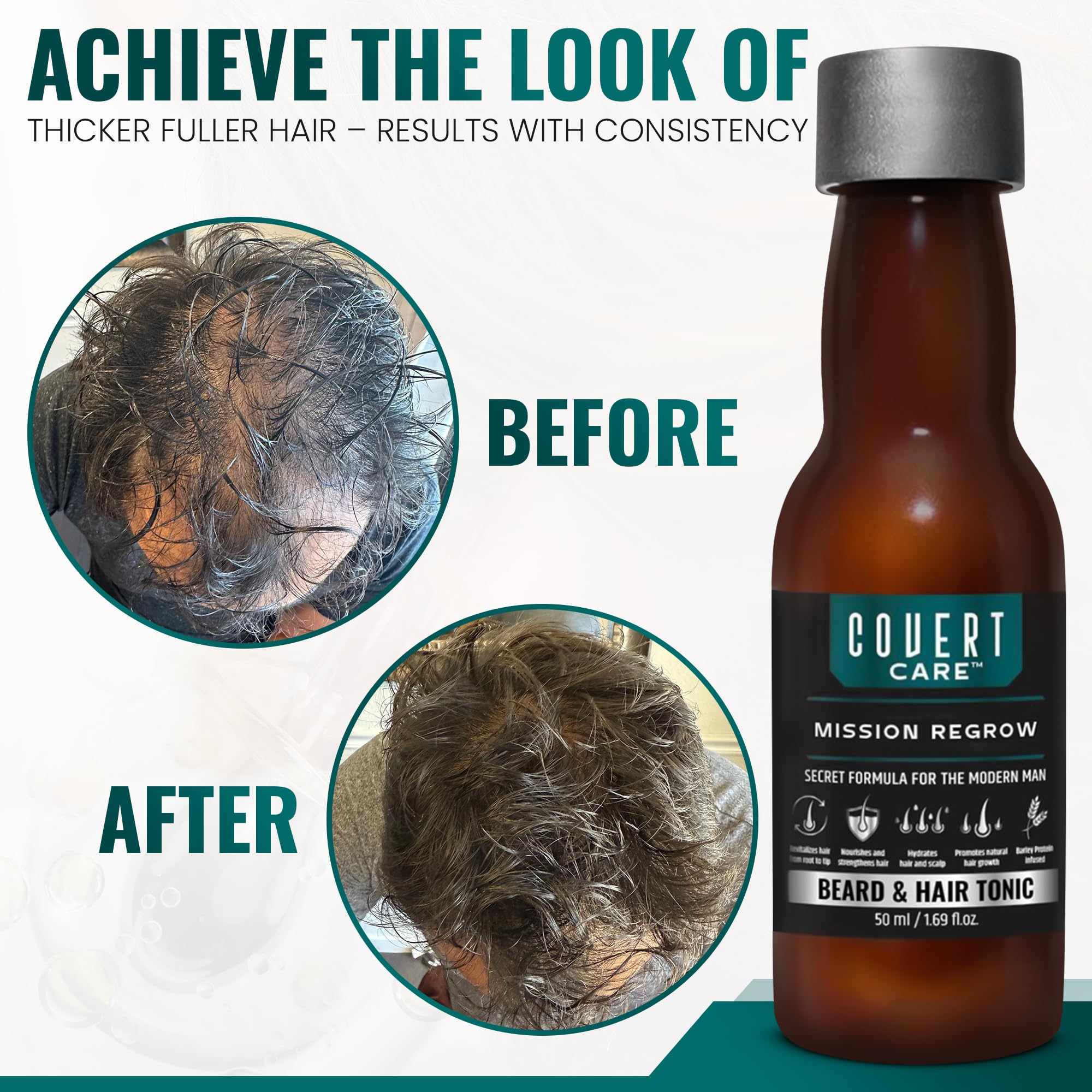Hair and Beard Thickening Serum for Men ā Lightweight Root Activator for Thinning Hair, Scalp Nourishment for Fuller, Stronger-Looking Hair