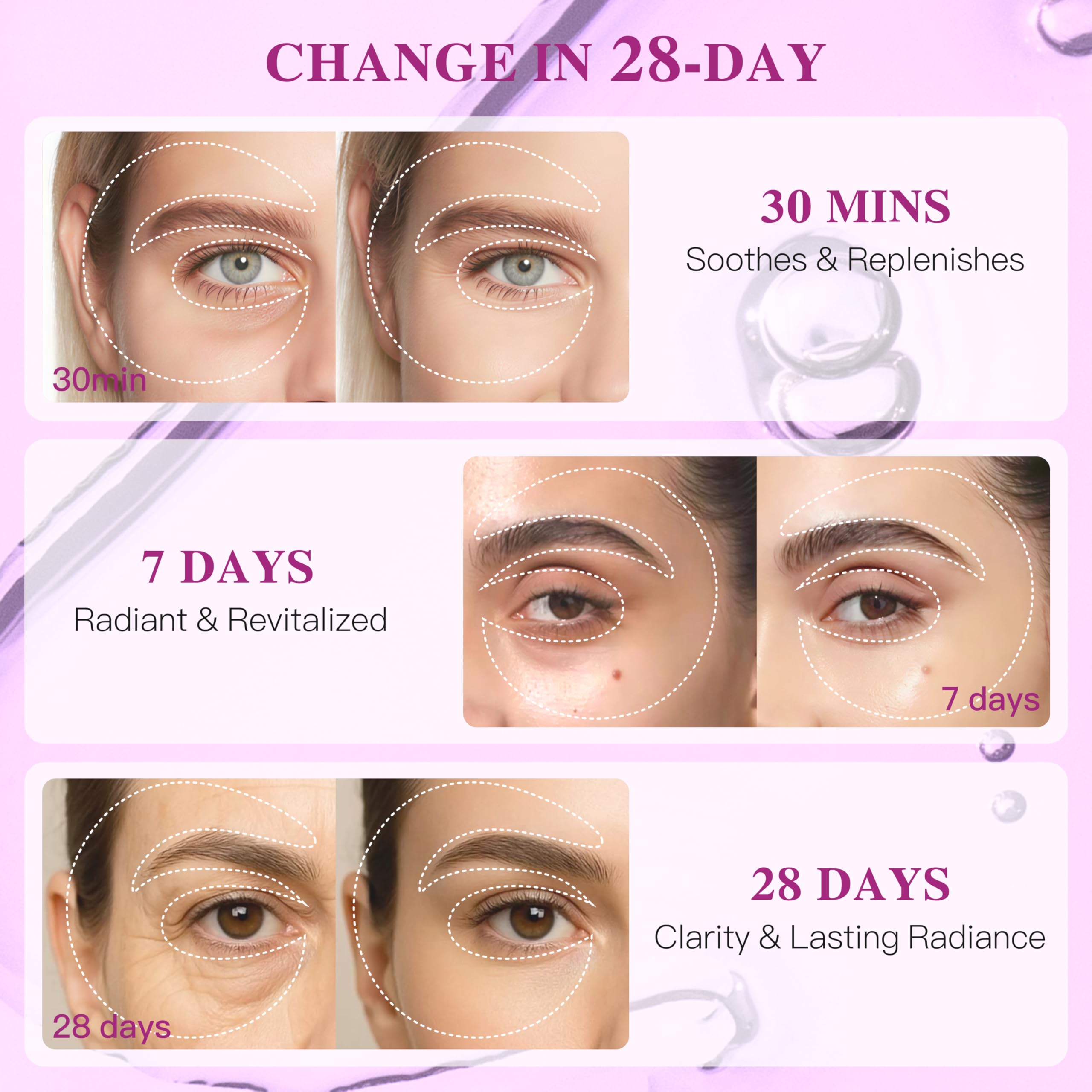ICIKOL Under Eye Patches with Collagen, Eye Patches for Puffy Eyes and Dark Circles, 360° Under Eye Mask for Puffiness, Wrinkles, Fine Lines, Gifts for Women - Skin Care, 12 Pairs (White)