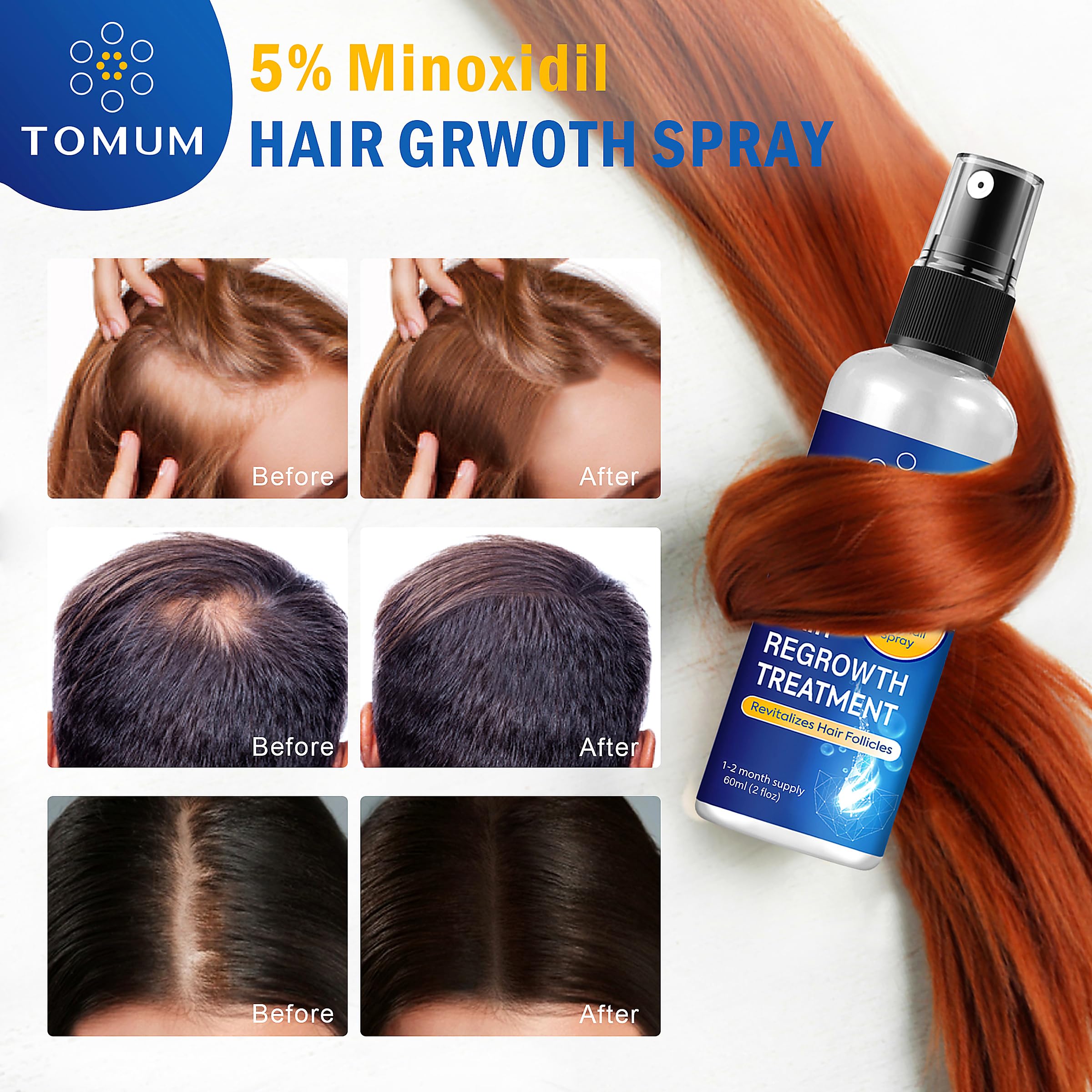 Minoxidil for Men and Women Hair Growth: 5% Minoxidil Topical Spray Hair Regrowth Treatment Stop Hair Thinning and Hair Loss For Stronger Thicker Longer Hair 60ml 2 Pack