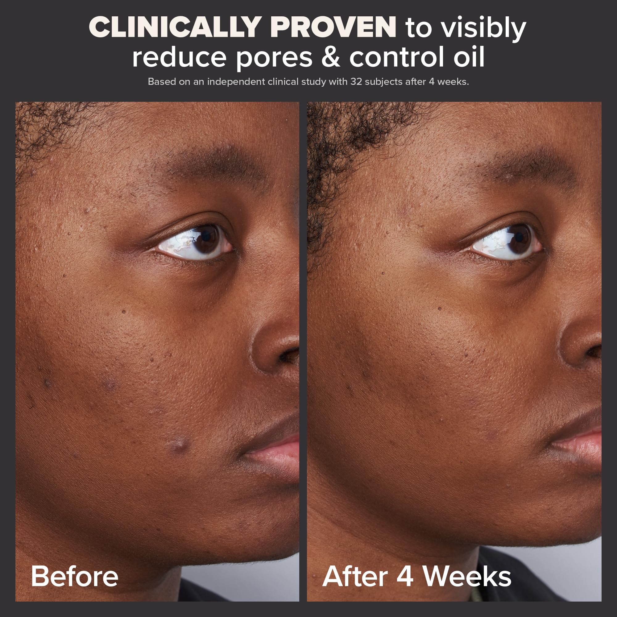 Paulas Choice--SKIN PERFECTING 2% BHA Liquid Salicylic Acid Exfoliant--Facial Exfoliant for Blackheads, Enlarged Pores, Wrinkles & Fine Lines, 4 oz Bottle