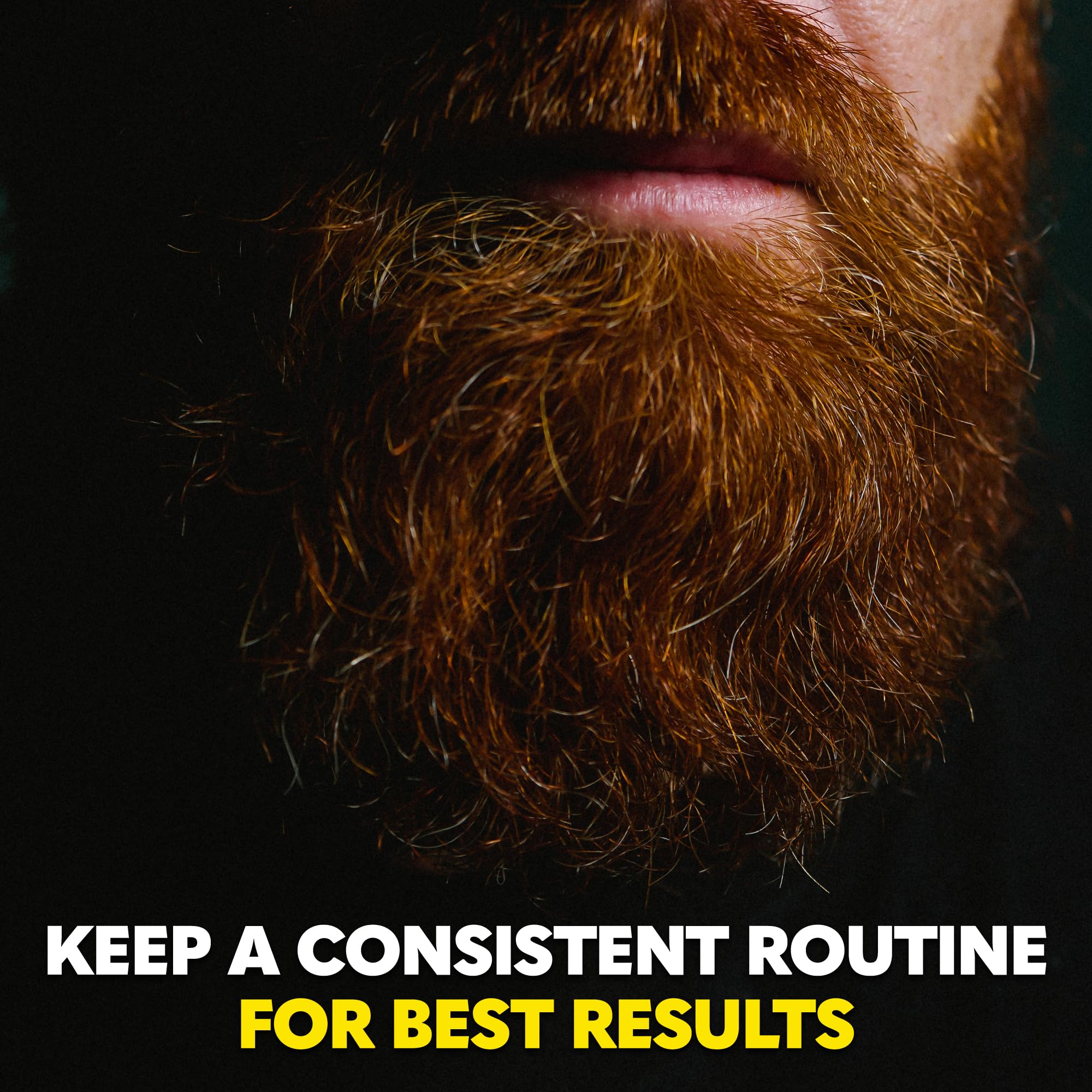 The Beard Club Derma Roller & Biotin Beard Growth Vitamin Spray - Microneedle Roller for Men and Women with 540 Titanium Microneedles - Roller & Beard Oil for Face, Body and Scalp - Vitamin B7, B5