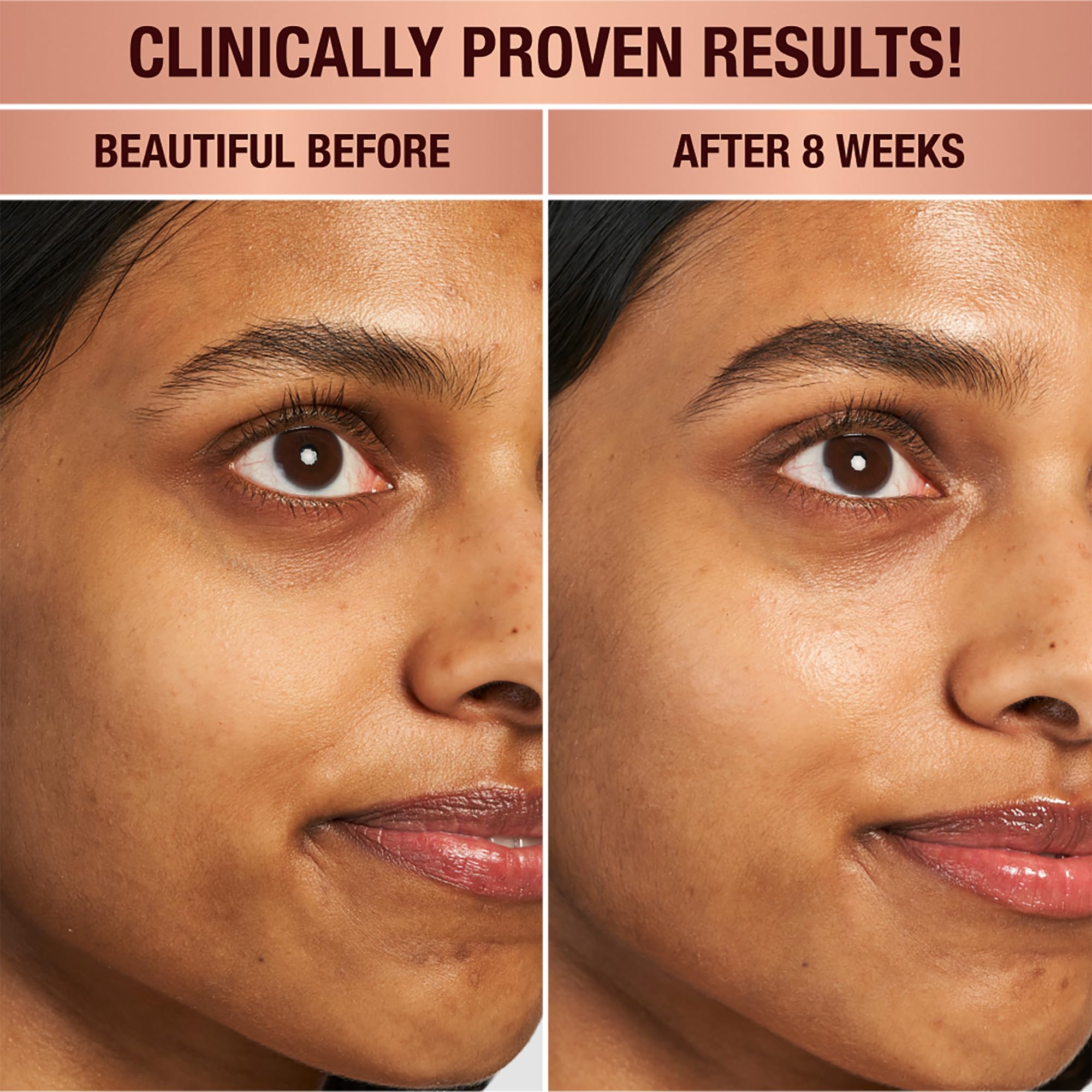 Charlotte Tilbury Magic Eye Rescue - Smoothing & Hydrating Under Eye Cream with Time-Released Retinol & Botanical Complex for Dark Circles, Puffiness & Fine Lines - For Smoother, Youthful Skin (15ml)