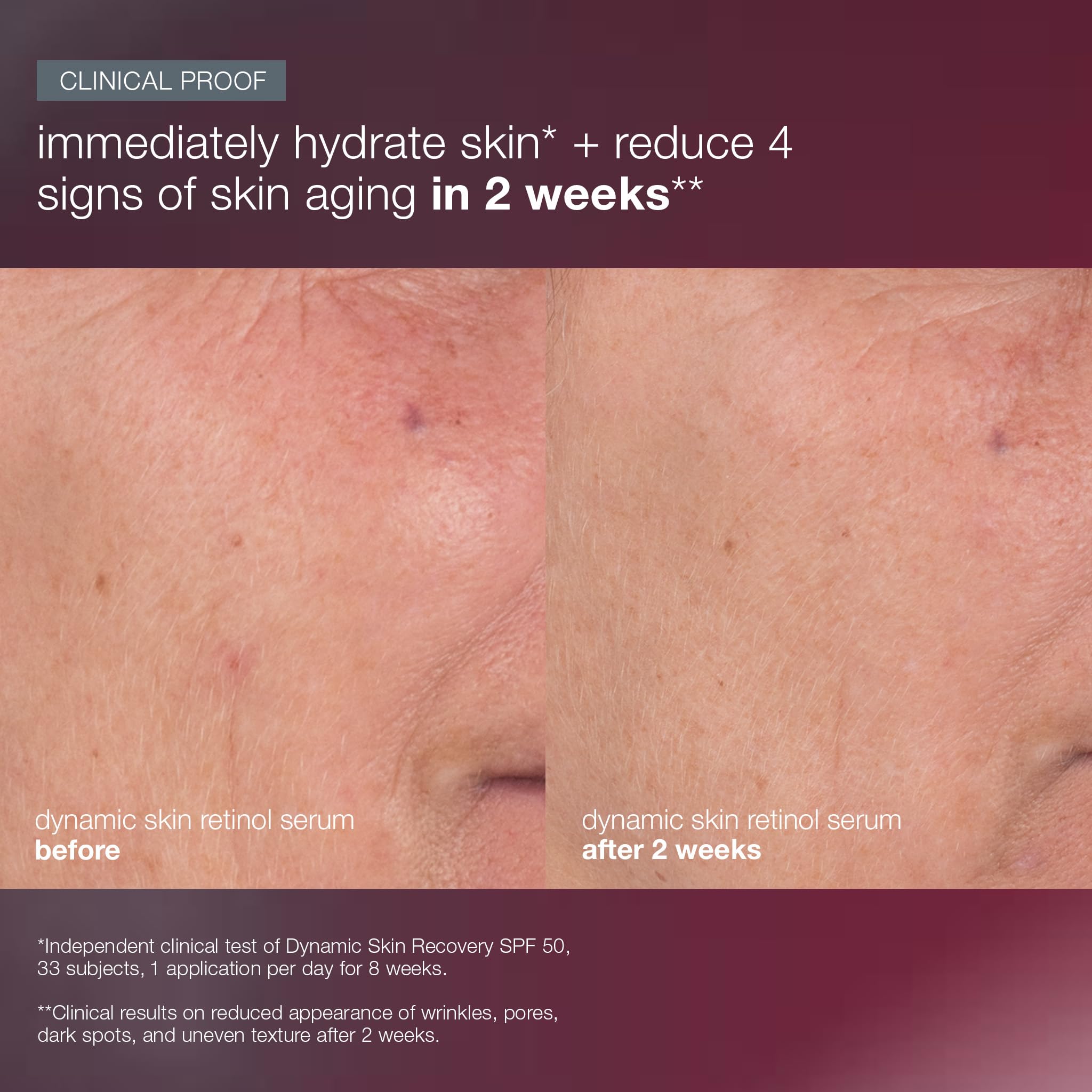 Dermalogica Skin Aging Solutions Kit, Anti Aging Skincare Set - Includes: Face Cleanser, Serum, Moisturizer with SPF, and Cream, Travel Size