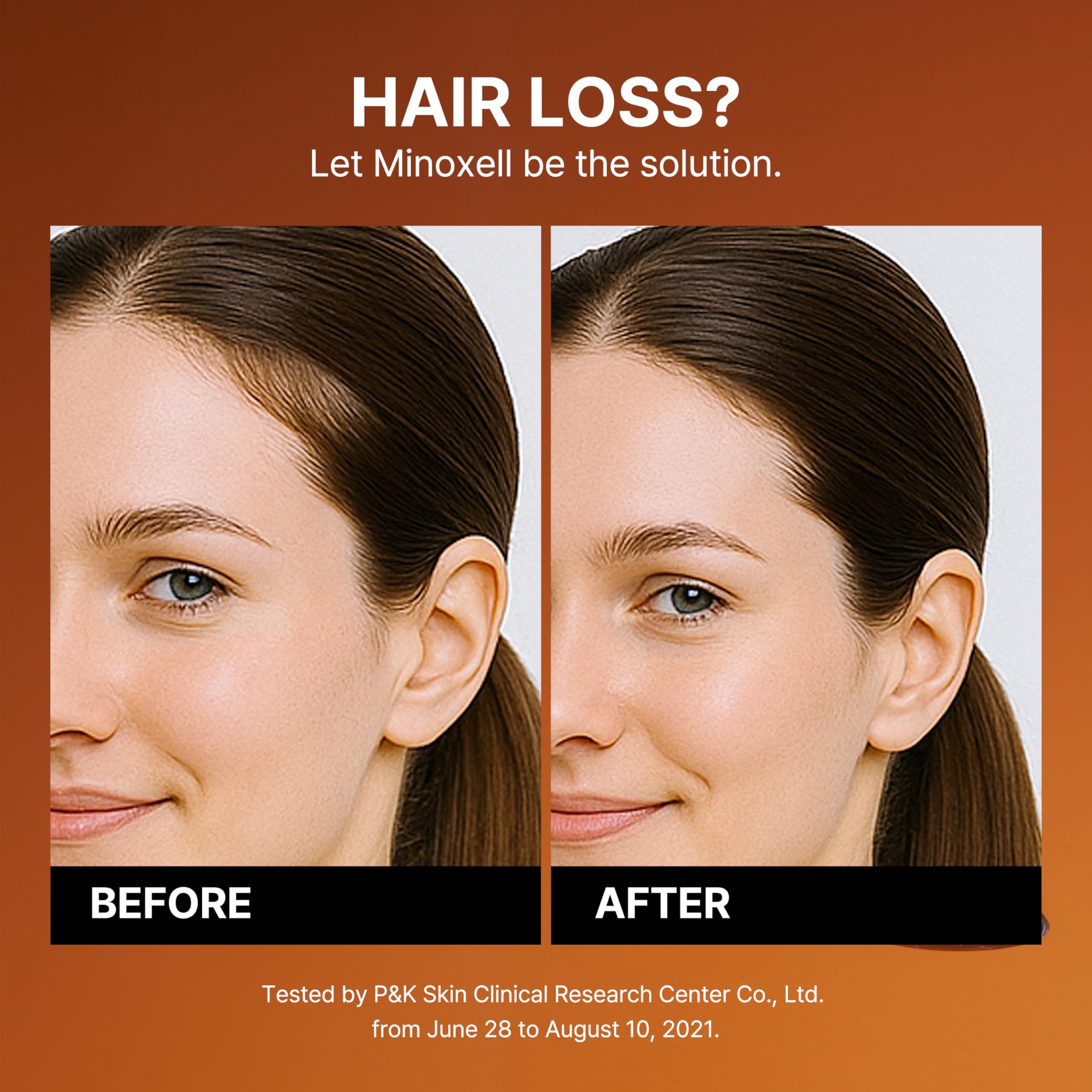 MINOXELL Scalp Intensive Shampoo with Biotin | Korean Shampoo for Hair Loss, Hair Regrowth, Thinning Hair, Volume Boost & Damage Repair (13.52 fl oz)