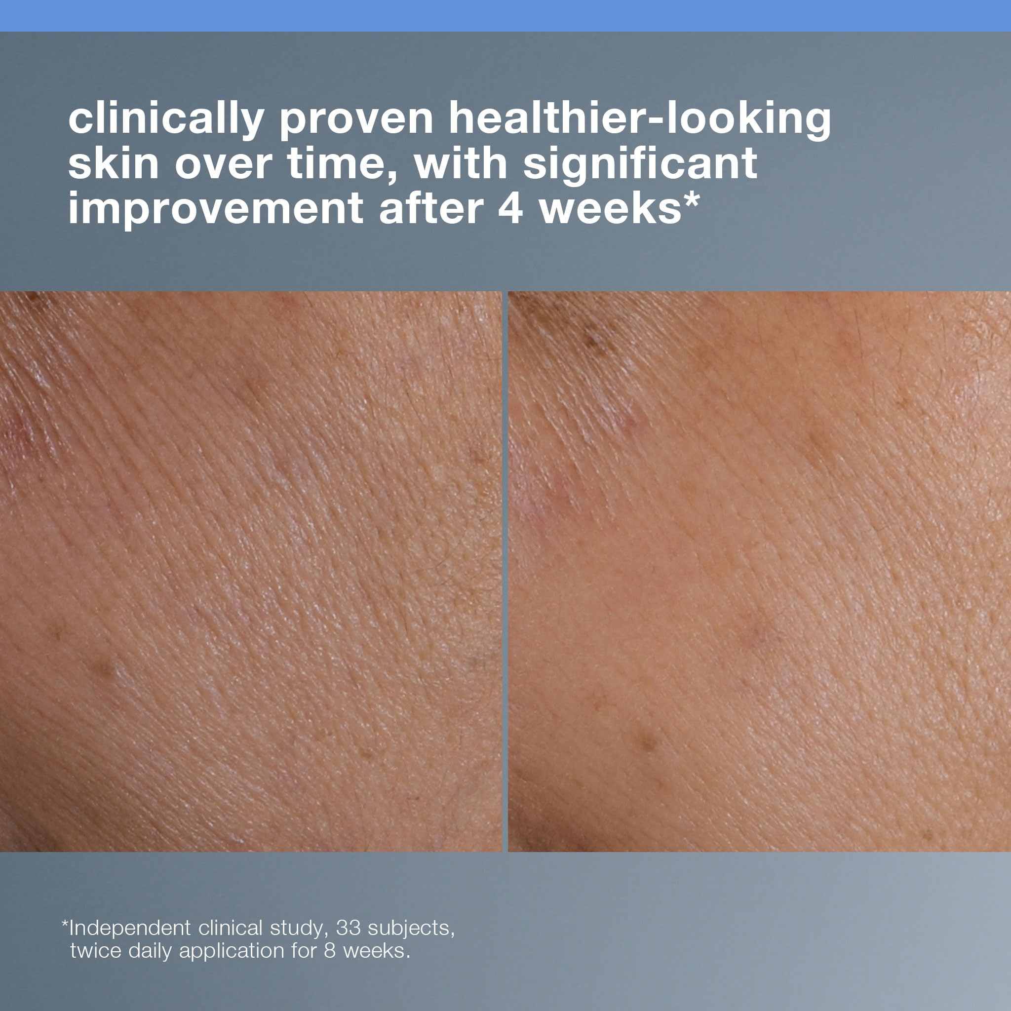 Dermalogica Smart Response Facial Serum, Anti Aging Serum with Lactic Acid and AHA, Hydrate, Brighten and Soothe Fine Lines and Wrinkles - 1.0 fl oz