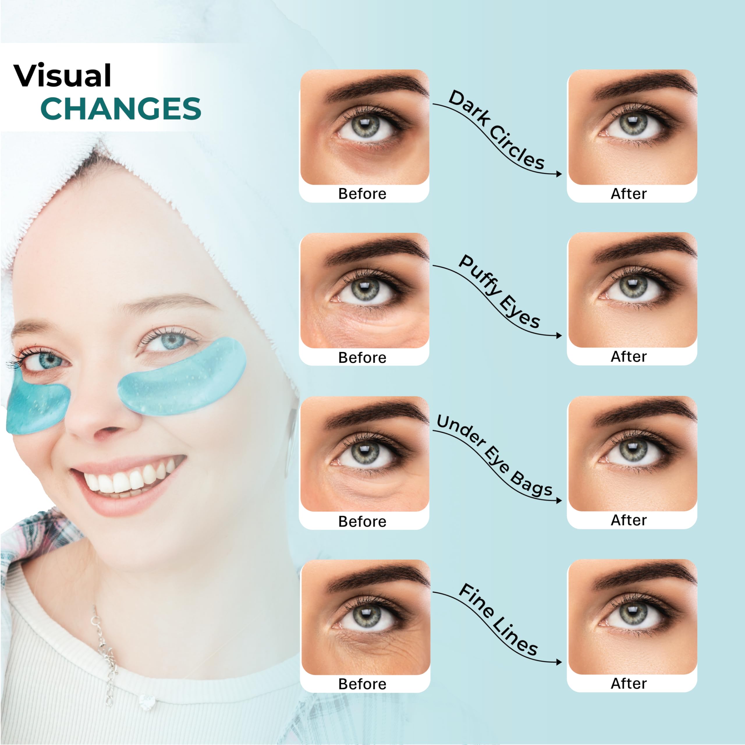 Cornice Herbs Healthy Healing 24K Gold Under Eye Masks – Collagen & Hyaluronic Acid Gel Patches for Dark Circles, Puffiness, Fine Lines – Eye Masks for Women & Men – 20 Pairs, Clean Beauty Skincare