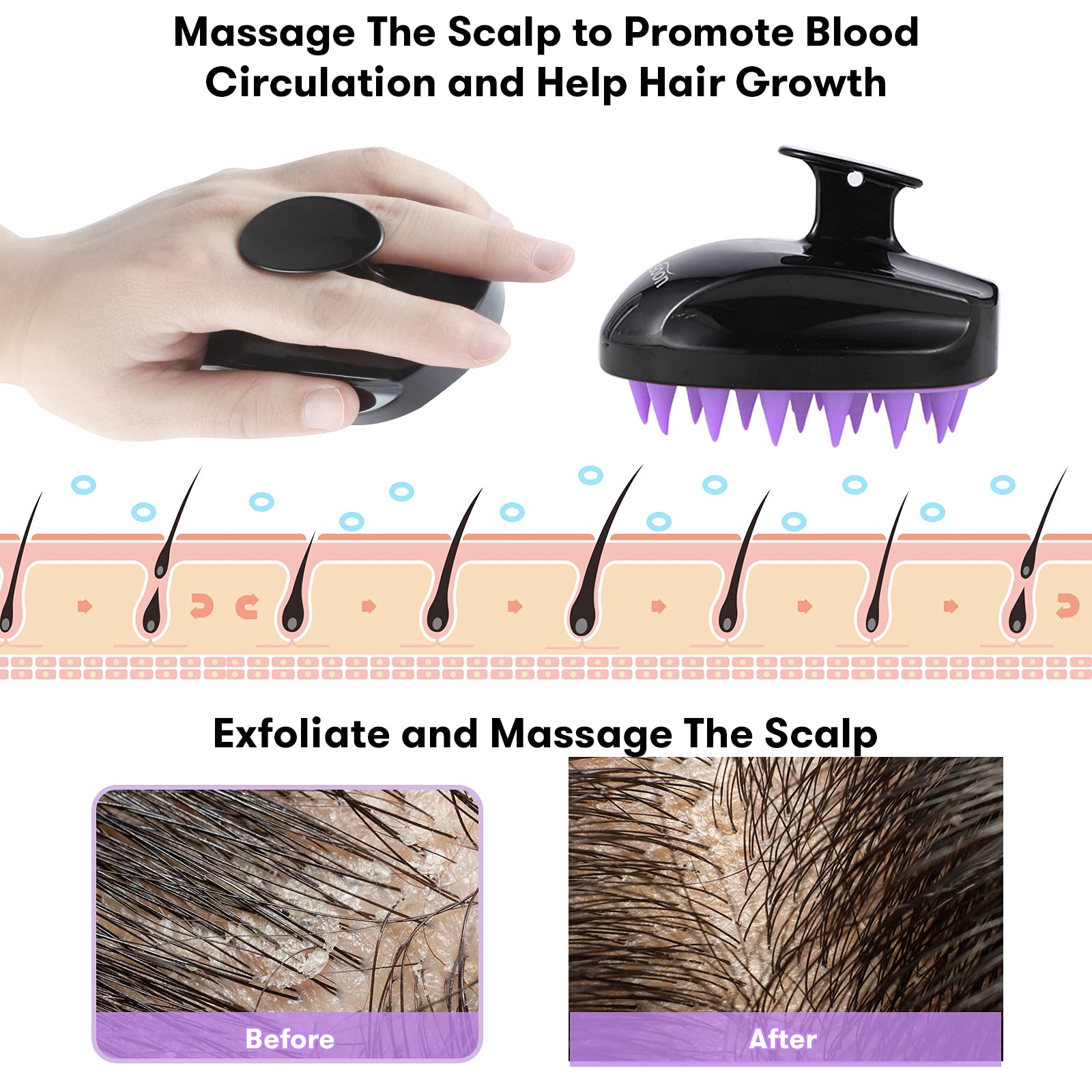 Scalp Massager, Shampoo Brush Hair Scrub Brush for Wet and Dry Hair, Soft Silicone Bristles Head Massager Clean Hair, Reduce Dandruff, Massage Scalp, Promote Hair Growth