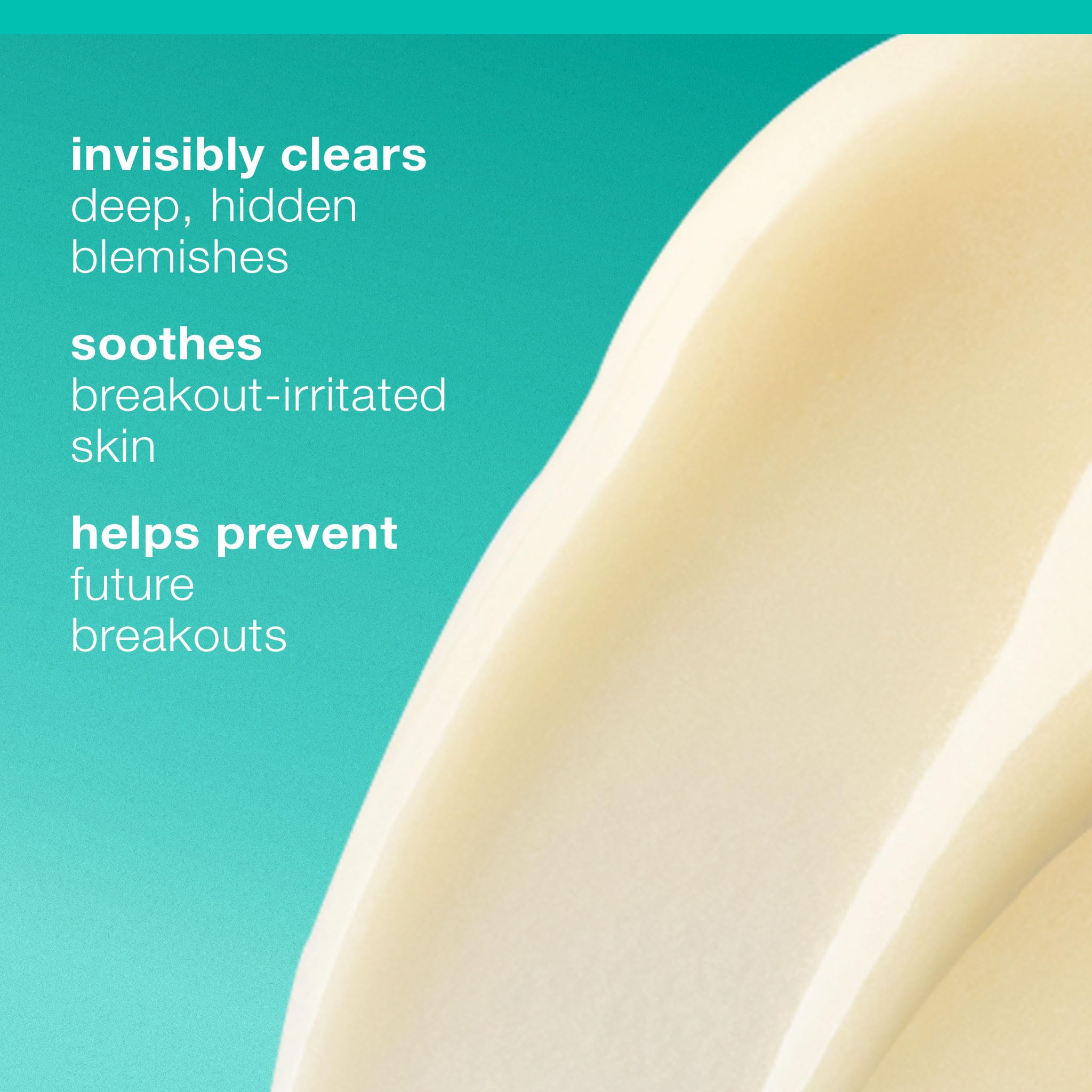 Dermalogica Deep Acne Liquid Patch, Invisible Spot Treatment for Pimple and Blemishes, Liquid to Patch Type Skin Soothing Clearing and Preventing Breakouts, Sulfur Based - 0.5 fl oz