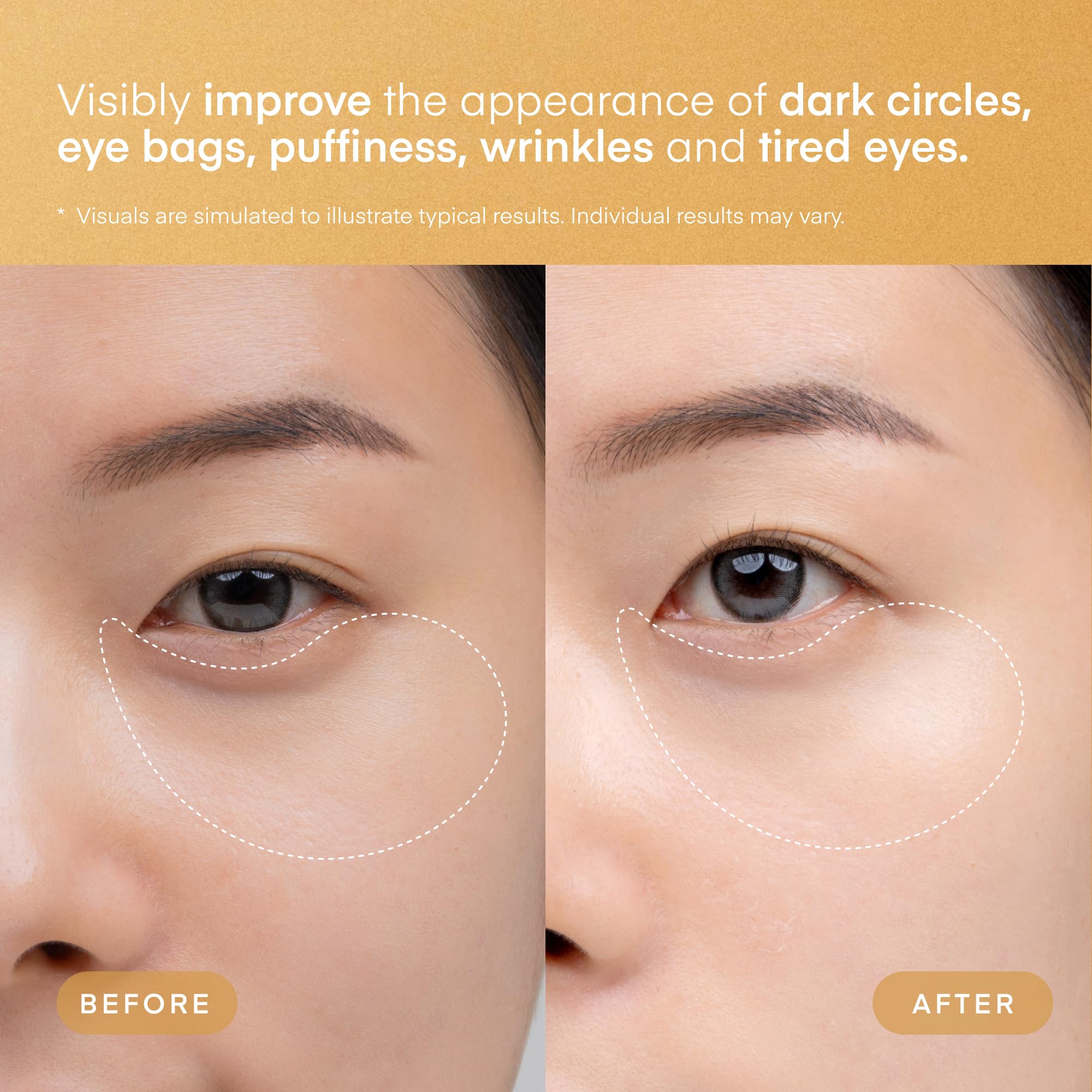 TEREZ & HONOR 24K Gold Retinol Under Eye Patches - 60 Korean Hydrogel Eye Masks with Collagen Peptide for Wrinkles, Dark Circles, Puffy Eyes, Radiance & Firming - Self Care, Gifts for Women and Men
