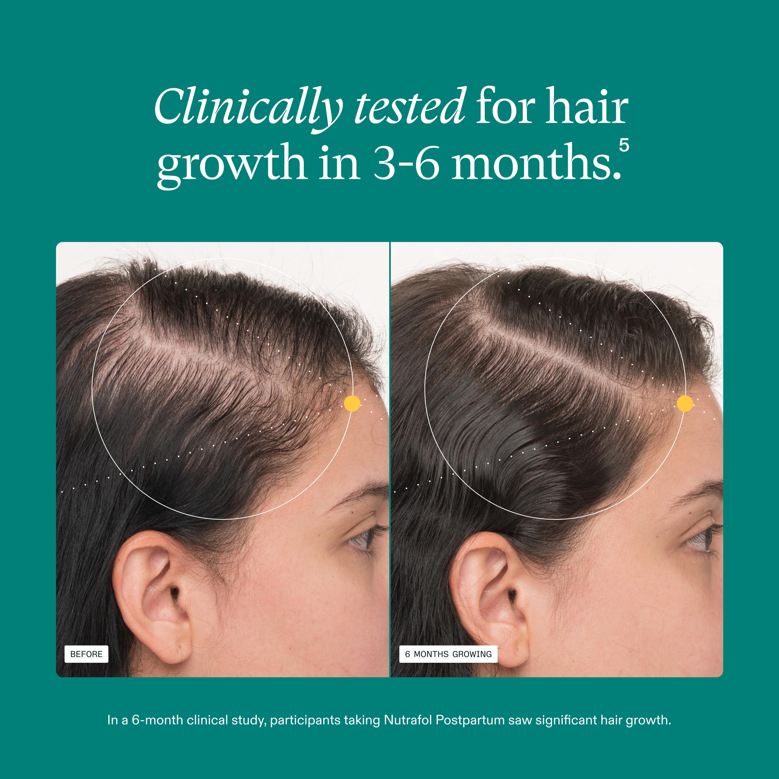 Nutrafol Postpartum Hair Growth Supplements, Clinically Tested for Visibly Thicker Hair and Less Shedding, Breastfeeding-Friendly - 2 Month Supply, 2 Refill Pouches