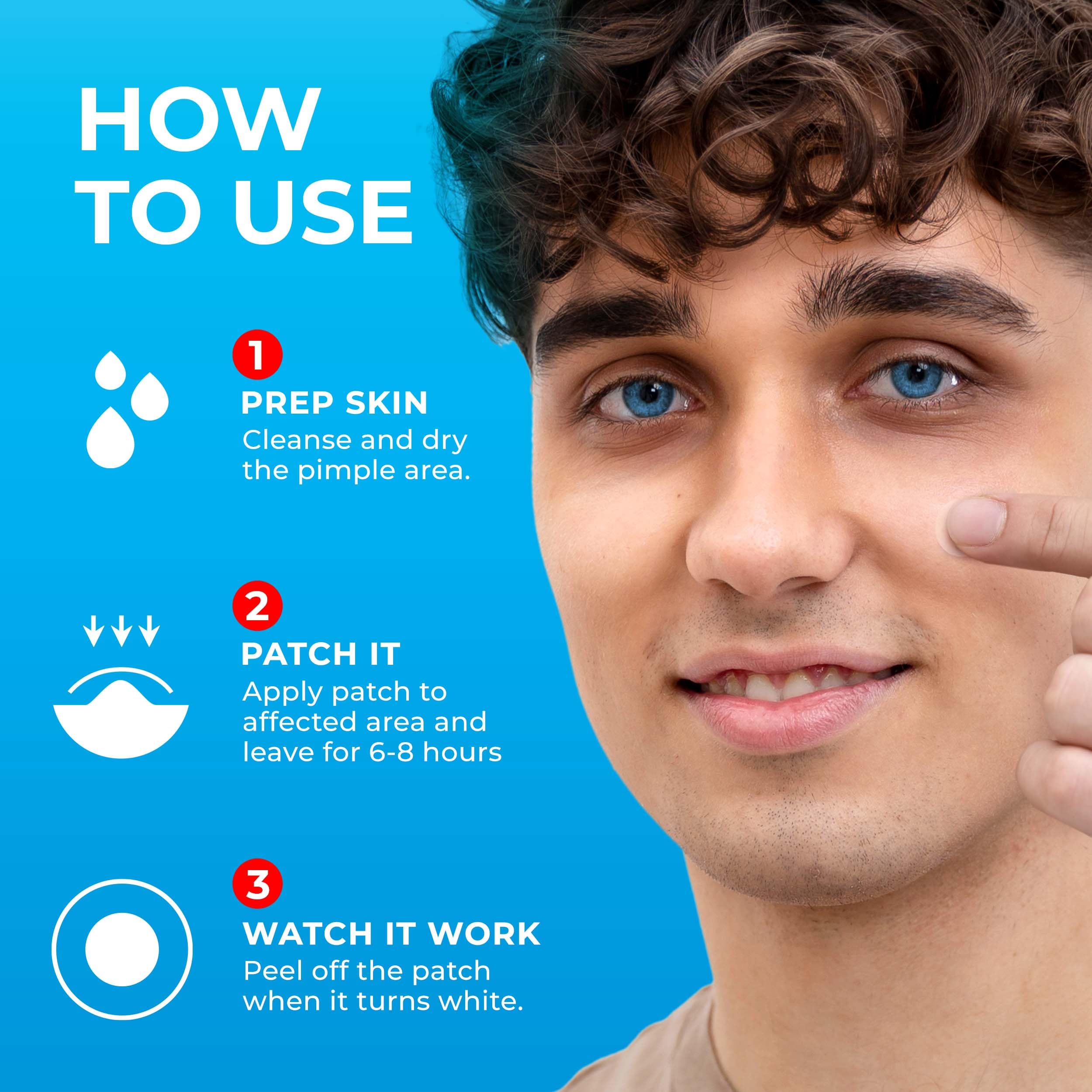 PatchRx Pimple Patches for Face (120 Patches), Hydrocolloid Acne Patches with Tea Tree Oil, Pimple Patch Pimple Stickers - Hydrocolloid Patch Acne Dots - Acne Pimple Patches For Face - Zit Patches
