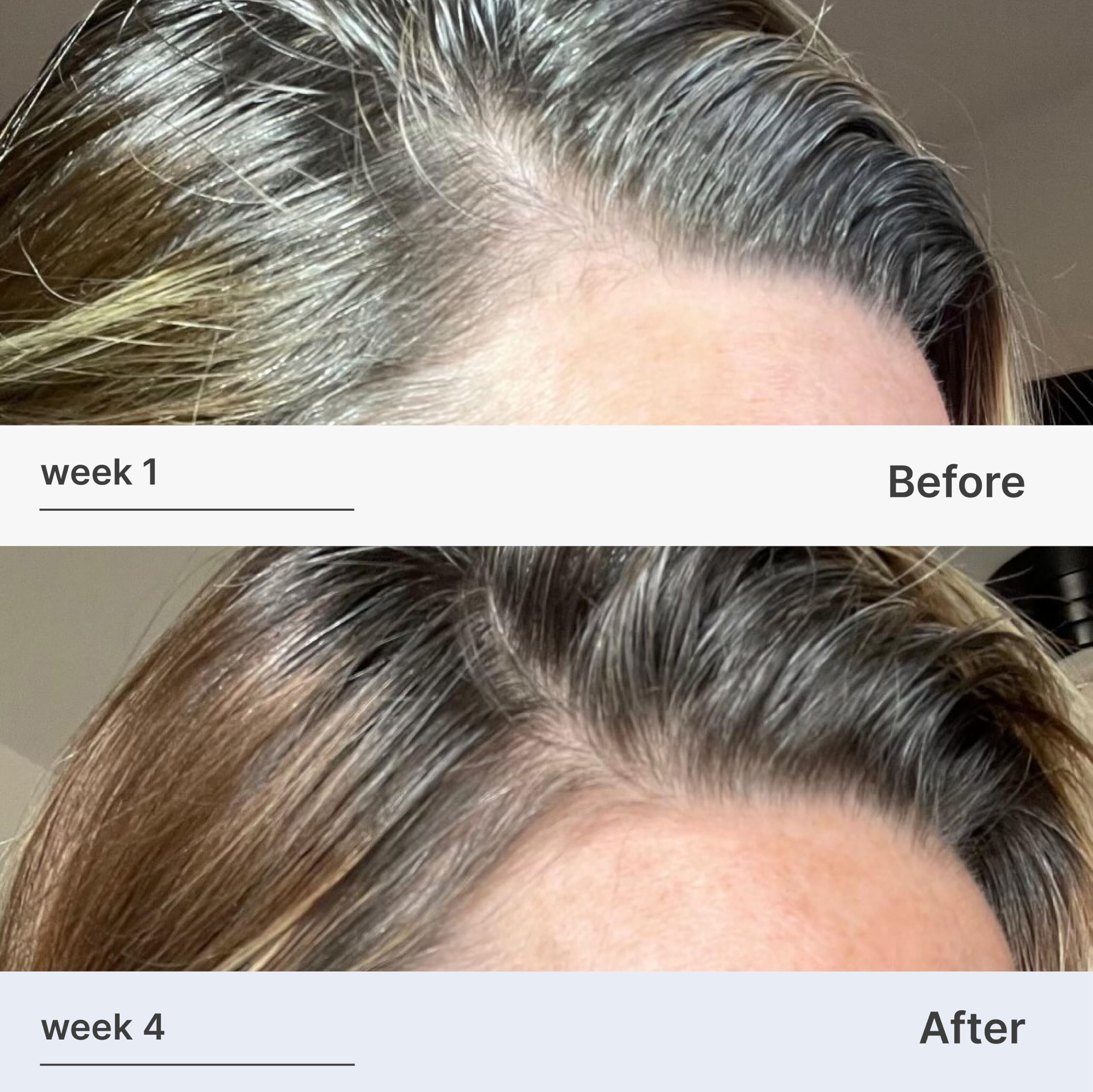 Better Not Younger Superpower Hair & Scalp Duo Set - Fortifying Hair & Scalp Serum 2fl.oz. plus Liquid Comb - Leave-in Hair Serum w/ Scalp Massaging Applicator for Stronger, Thicker, Fuller Hair