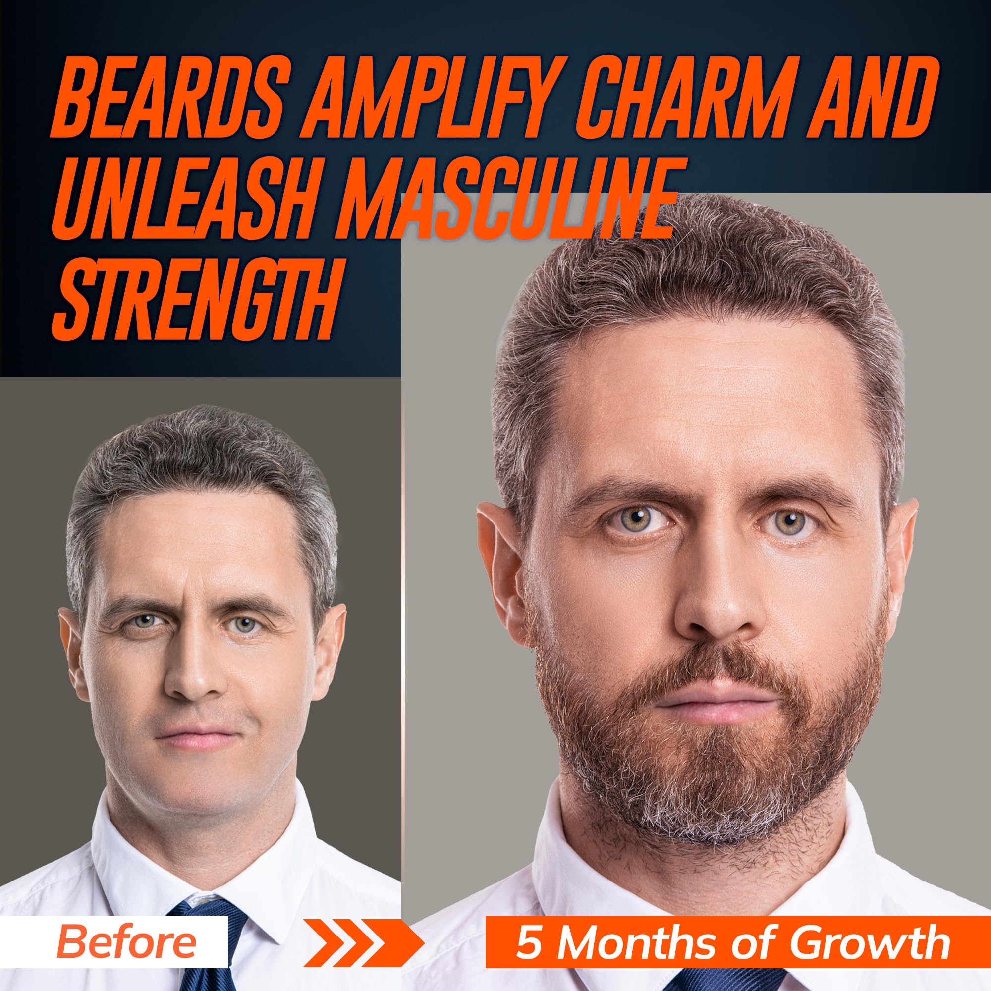 Complete Hair & Beard Growth Solution – Rosemary & Biotin Nourishing Serum for Men and Women – 2 Bottles 60ML