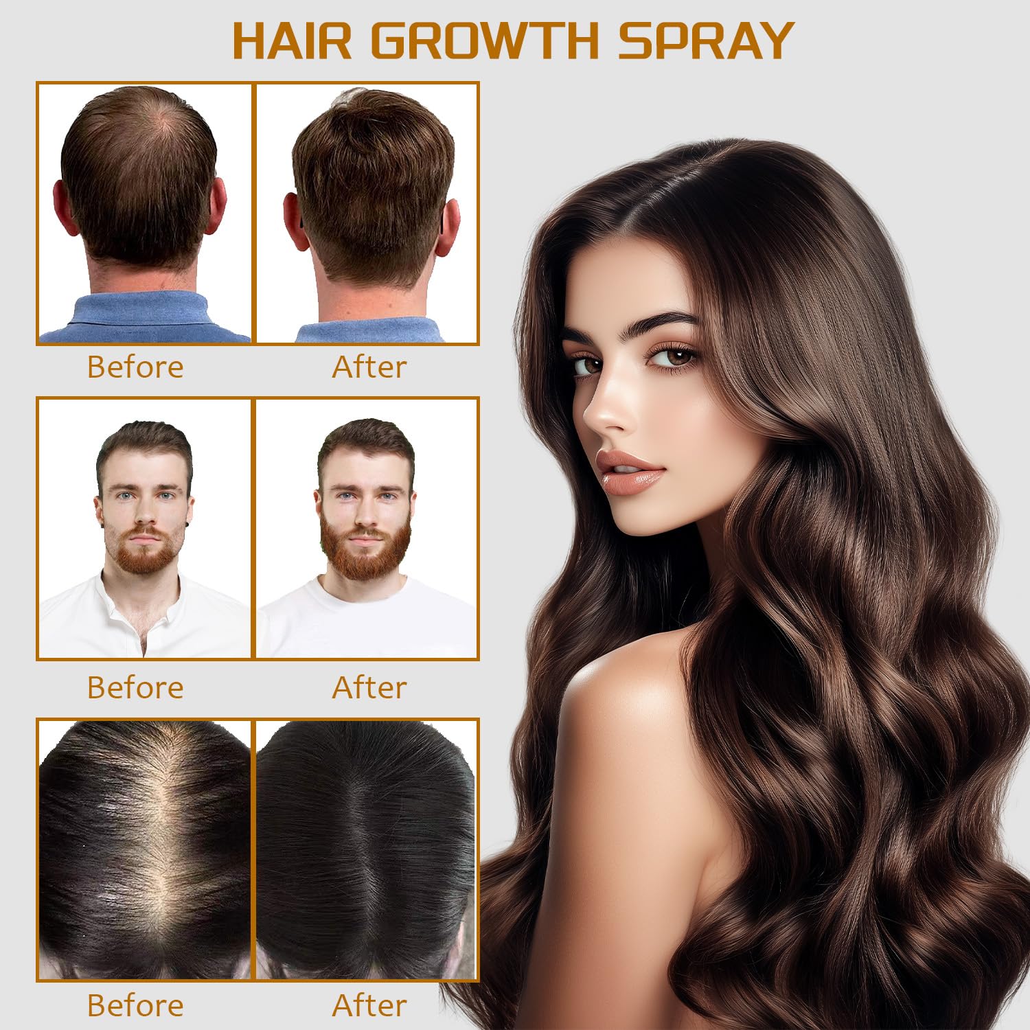 5% Minoxidil Spray with Biotin - Regrowth Treatment for Men Women, Promotes Thicker, Stronger, Fuller Hair, Prevents Hair Loss, for Men Hair & Beard, for Women Hair Growth (3.38, Minoxidil)