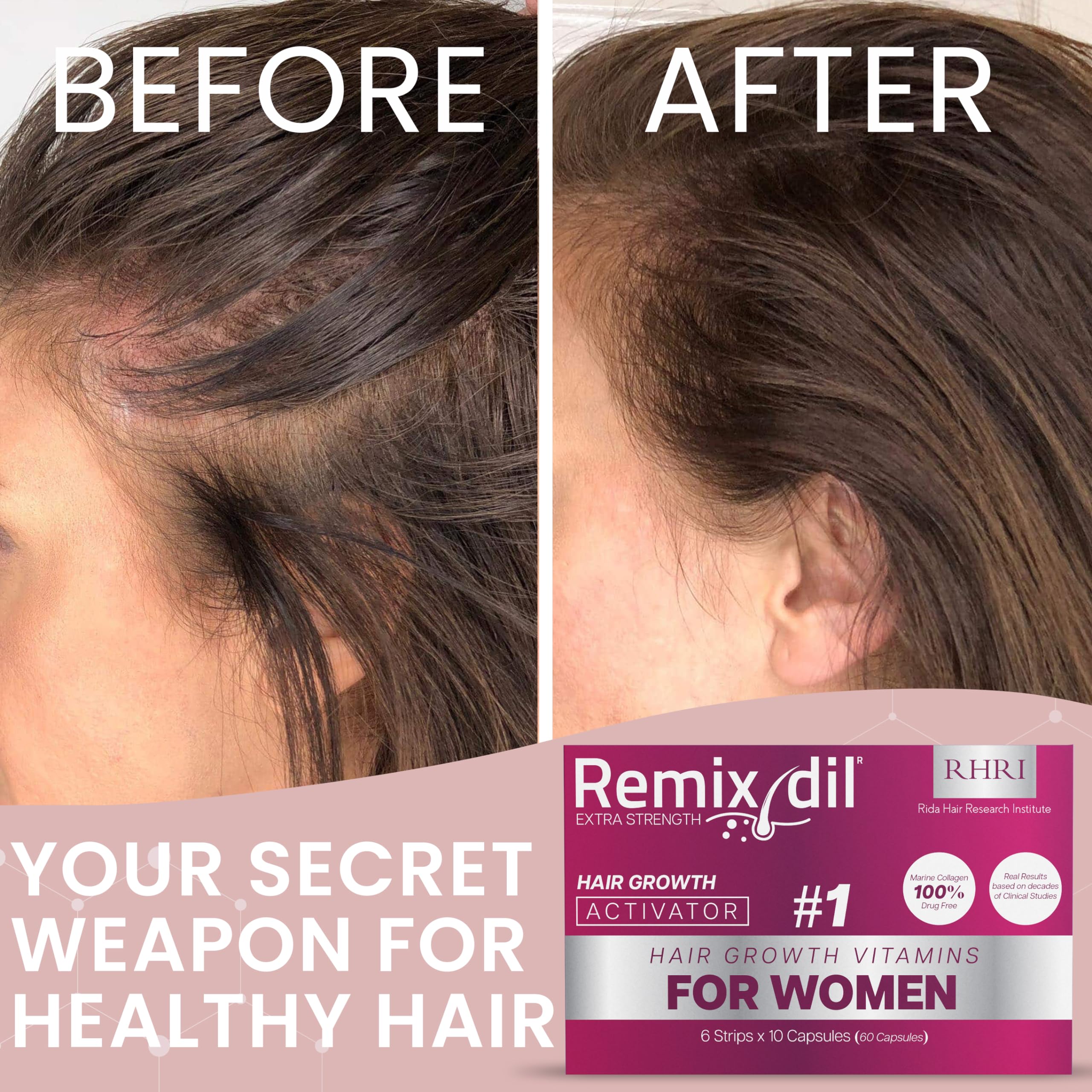 Hair Growth Vitamins Hair Growth Supplements For Women | Supports Thickness And Strength | Helps Reduce Breakage And Thinning | Promotes Healthy Scalp Function | 60 Capsules