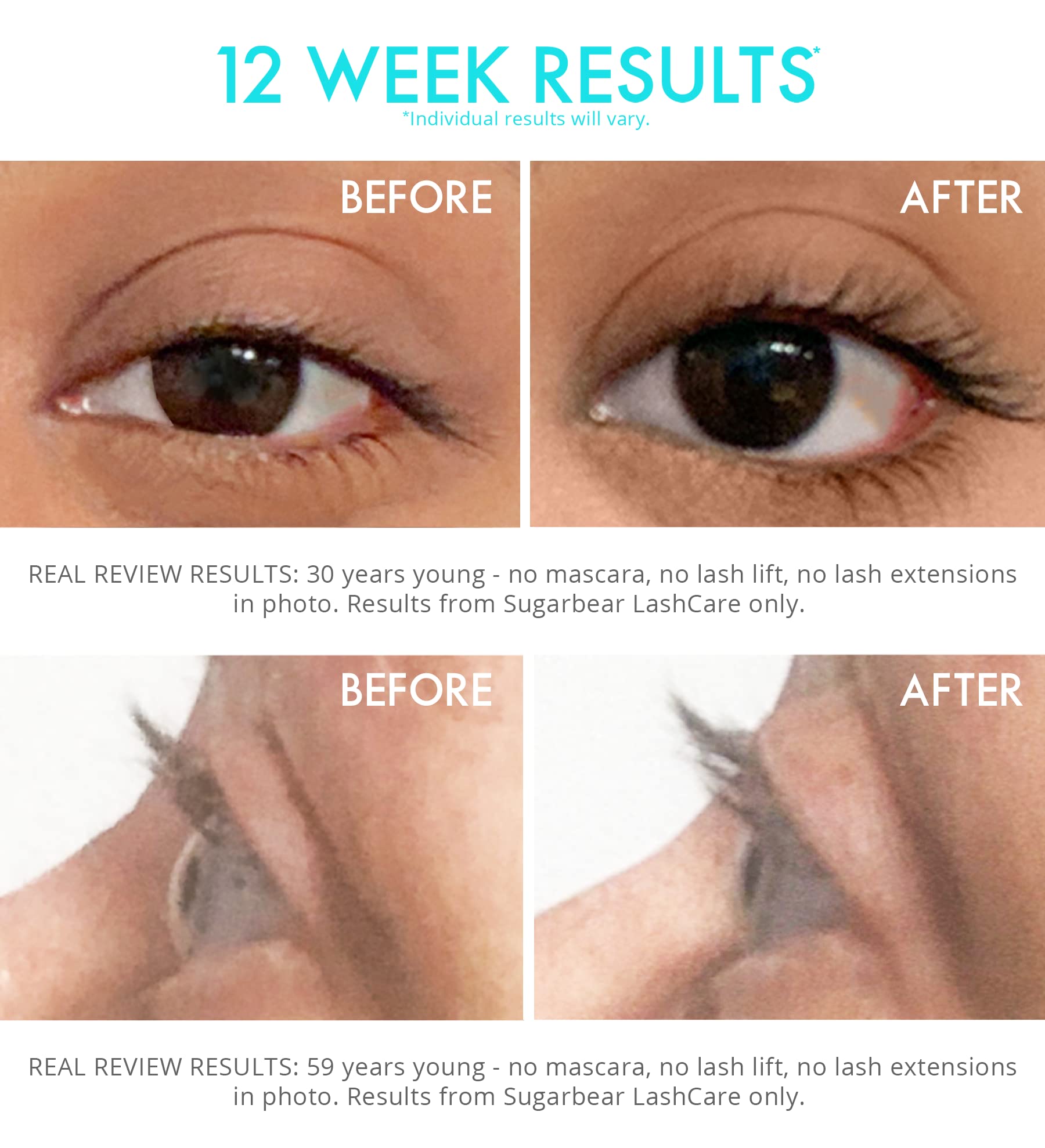 SUGARBEAR® LashCare, Lash Enhancing Serum, Promotes Appearance of Longer, Thicker Eyelashes, Cruelty Free & Vegan (3 Month Supply)