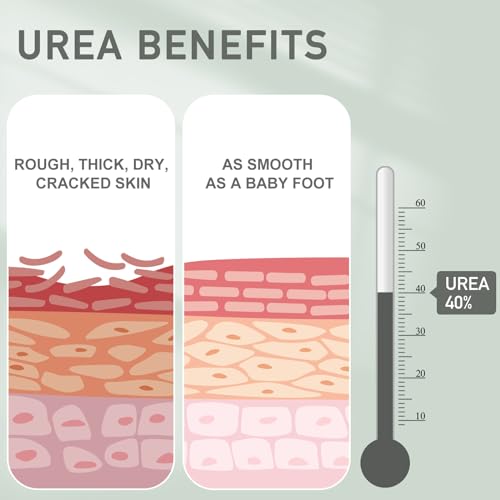 Urea Cream 40 Percent -Pro Foot & Hand Cream, for Dry, Cracked Heels, Feet, Knees, Elbows, and Hands,Callus Remover,Maximum Strength Urea Lotion for Softening and Moisturizing