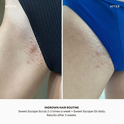 Bushbalm Dark Spots and Ingrown Hair 2 Step Routine - Rejuvenate and Nourish - Ingrown Hair Oil (30 ml) and Exfoliating Scrub (236 ml) - Bermuda