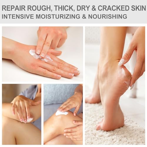 Urea Cream 40 Percent -Pro Foot & Hand Cream, for Dry, Cracked Heels, Feet, Knees, Elbows, and Hands,Callus Remover,Maximum Strength Urea Lotion for Softening and Moisturizing
