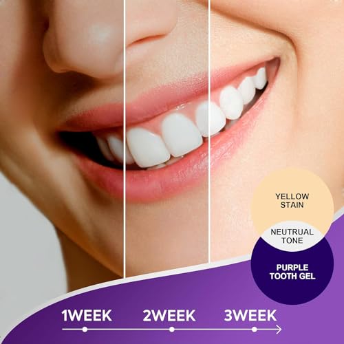 RUIGEQIJI Purple Toothpaste for Teeth Whitening: Teeth Whitening Toothpaste - Deep Cleaning Teeth Stain Remover, Colour Correcting Teeth Whitening Kit for Sensitive Teeth, Fruity Flavor, 50ML