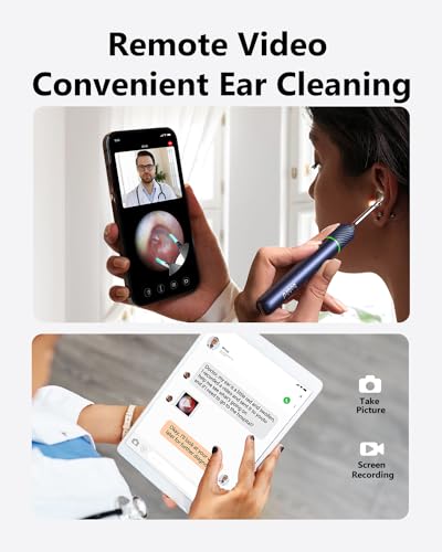 [Cutting-Edge] BEBIRD Note5 Ear Wax Removal Tool: Ear Cleaner with Camera 10 Megapixel Otoscope, Omni-Direction Tweezer, Real-Time Remote Video, Magnetic Cap, Multi Earwax Cleaning Replacement Tips