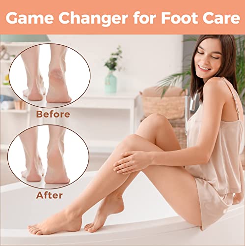 Foot File Foot Scrubber Pedicure - Callus Remover for Feet Easkep Professional Grater Rasp Foot Scraper Corns Callous Removers Cracked Dead Skin Remover for Dry and Wet Feet (Golden)