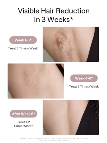 Ulike Laser Hair Removal for Women and Men, Air 3 Ice-Cooling IPL Device Hair Removal for Nearly Painless & Long-Lasting Results, 3 Modes & Auto Flashing for Fast Full Body Hair Removal from Home