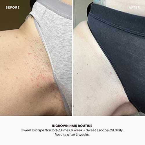 Bushbalm Dark Spots and Ingrown Hair 2 Step Routine - Rejuvenate and Nourish - Ingrown Hair Oil (30 ml) and Exfoliating Scrub (236 ml) - Bermuda