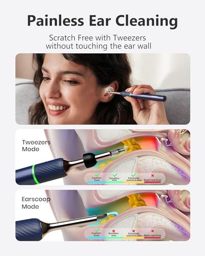 [Cutting-Edge] BEBIRD Note5 Ear Wax Removal Tool: Ear Cleaner with Camera 10 Megapixel Otoscope, Omni-Direction Tweezer, Real-Time Remote Video, Magnetic Cap, Multi Earwax Cleaning Replacement Tips