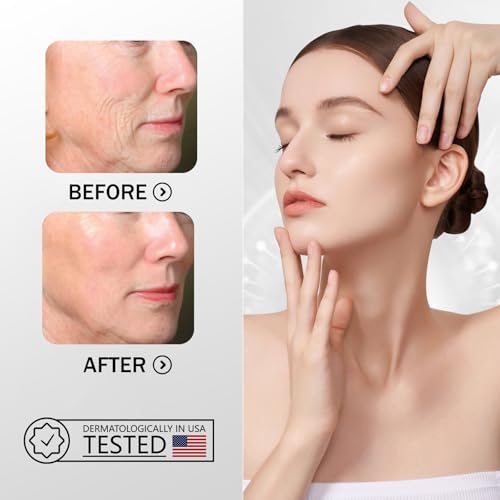 ZMbeauty Forehead Wrinkle Patches, 15 Prs Anti Wrinkle Facial Patches to Smile Line, Forehead and Mouth, Lift Lines Treatment with Collagen, Centella Asiatica for Women & Men