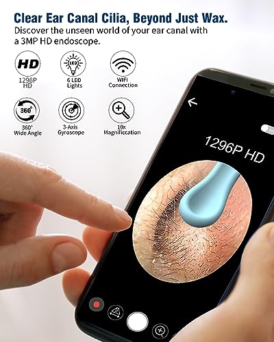 Kekoy Ear Wax Removal Camera, Ear Cleaner 1296P HD Camera, Ear Cleaning Kit with 8pcs Ear Set, Wireless WiFi Otoscope with 6 Lights, Rechargeable Earwax Removal Tool Kit for Adult & Kid(Black)