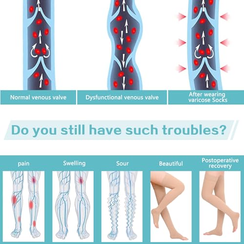 Athvibid Thigh High 20-30mmHg Compression Stocking Toeless Compression Socks for Women & Men Circulation with Silicone Dot Band,Relieves muscle soreness