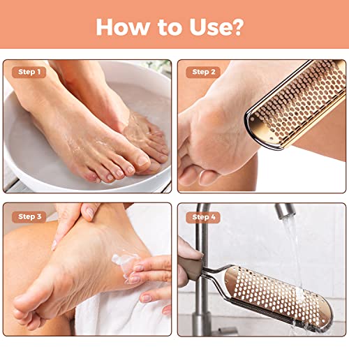 Foot File Foot Scrubber Pedicure - Callus Remover for Feet Easkep Professional Grater Rasp Foot Scraper Corns Callous Removers Cracked Dead Skin Remover for Dry and Wet Feet (Golden)