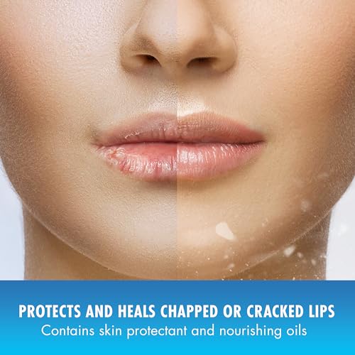 Natural Ice Original SPF 15 Medicated Lip Balm - 12 Count Pack