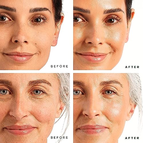 Tree of Life Facial Skin Care Set, Brightening, Firming, Hydrating, Dry Face, Dermatologist Tested - Vitamin C Serum (Brightens) + Retinol Serum (Smooths) - Skin Care Kit, 2 count of 1 Fl Oz