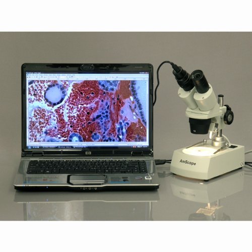 AmScope SE306R-PZ-LED Forward-Mounted Binocular Stereo Microscope, WF10x and WF20x Eyepieces, 20X/40X/80X Magnification, 2X and 4X Objectives, Upper and Lower LED Lighting, Reversible Black/White Stage Plate, Pillar Stand, 120V or Battery-Powered