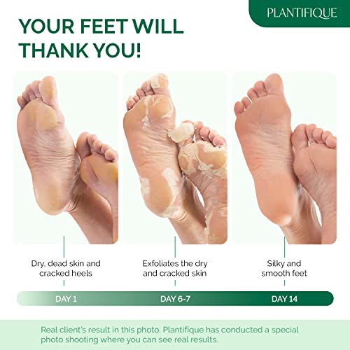 PLANTIFIQUE Foot Peeling Mask for Men Foot Mask Dermatologically Tested Repairs Heels & Removes Dry Dead Skin for Baby Soft Feet - Exfoliating Foot Peel Mask for Dry Cracked Feet (2 pack)