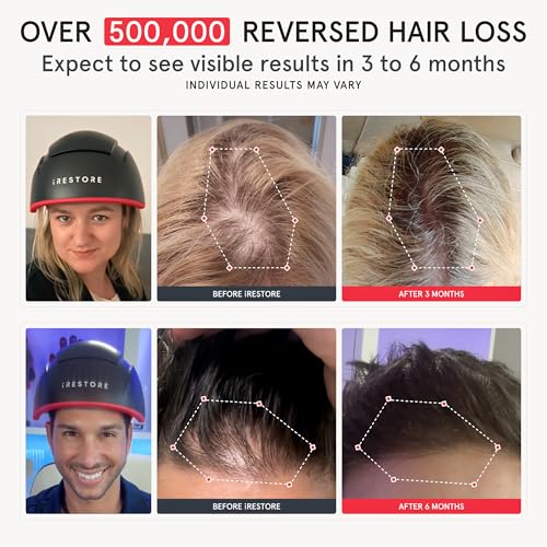 iRESTORE Elite Laser Hair Growth System - World's Best FDA Cleared Red Light Therapy Cap for Hair Regrowth - Hair loss Treatment for Men & Women - Stimulates Hair Growth for Denser Fuller Hair