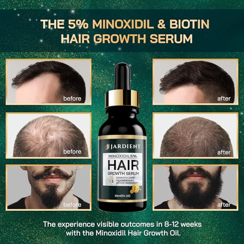 Jardient Minoxidil 5% Serum for Men and Women: Hair Growth Oil with Monoxide, Biotin, Beard Growth Kit - Minoxidil Serum - 1 Fl Oz - Prevent Hair Loss, Regrowth Treatment